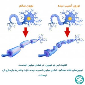 نورون