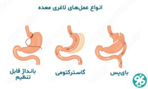 کاهش وزن