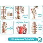 موارد استفاده از کمربند طبی اورتینو مدل TLSO Brace