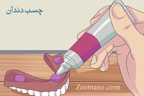چسب دندان مصنوعی چیست؟