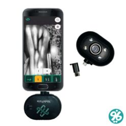 خرید دستگاه رگ یاب Mobivein