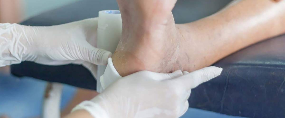 پانسمان کردن زخم پای دیابتی