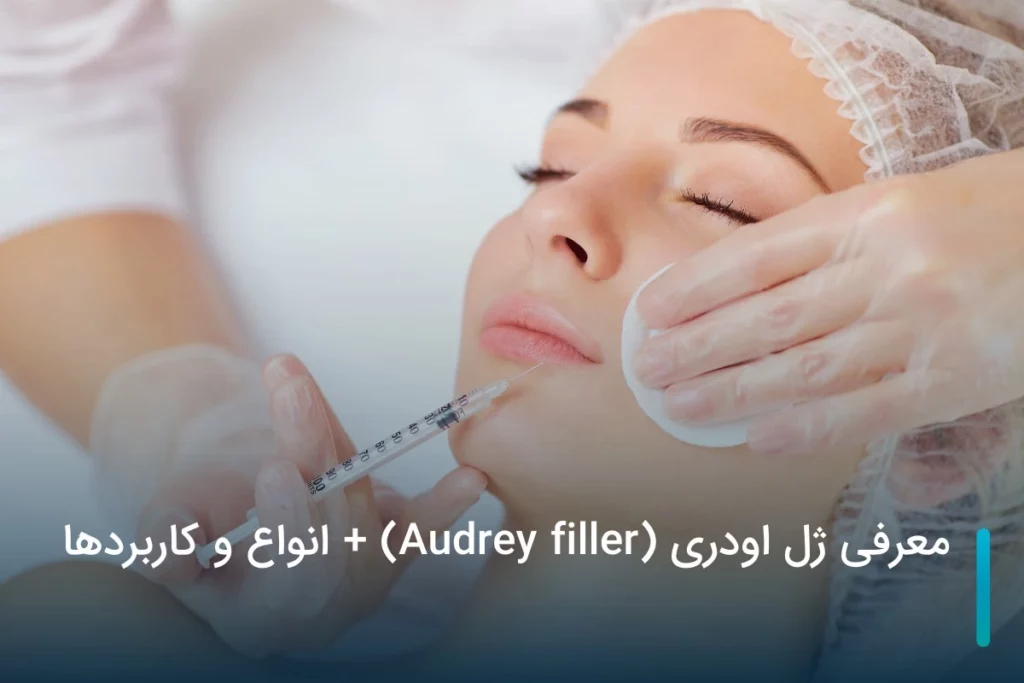 معرفی ژل اودری (Audrey filler) + انواع و کاربردها