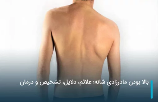 بالا بودن مادرزادی شانه؛ علائم، دلایل، تشخیص و درمان
