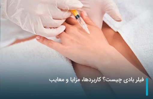 فیلر بادی چیست؟ کاربردها، مزایا و معایب