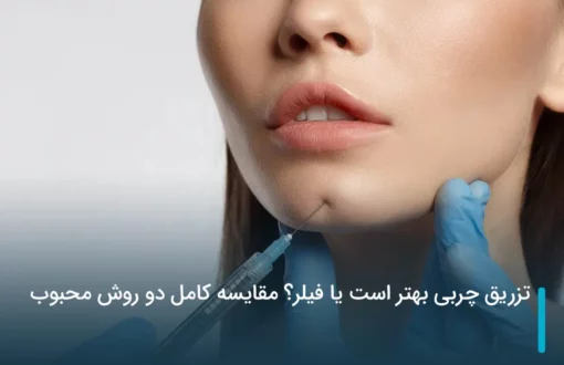 تزریق چربی بهتر است یا فیلر؟