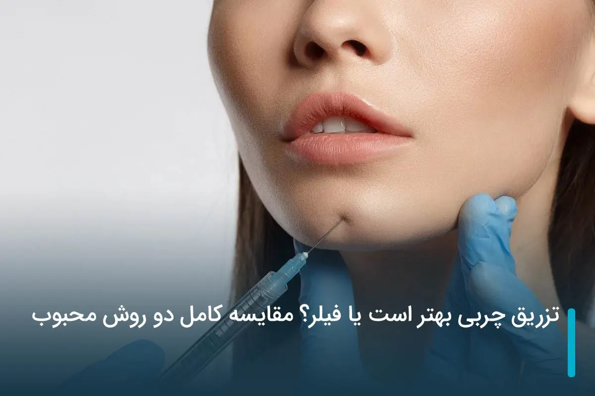 تزریق چربی بهتر است یا فیلر؟