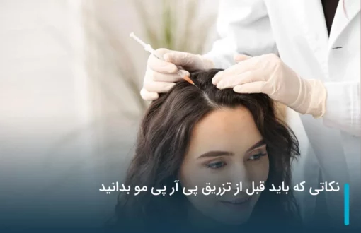نکاتی که باید قبل از تزریق پی آر پی مو بدانید