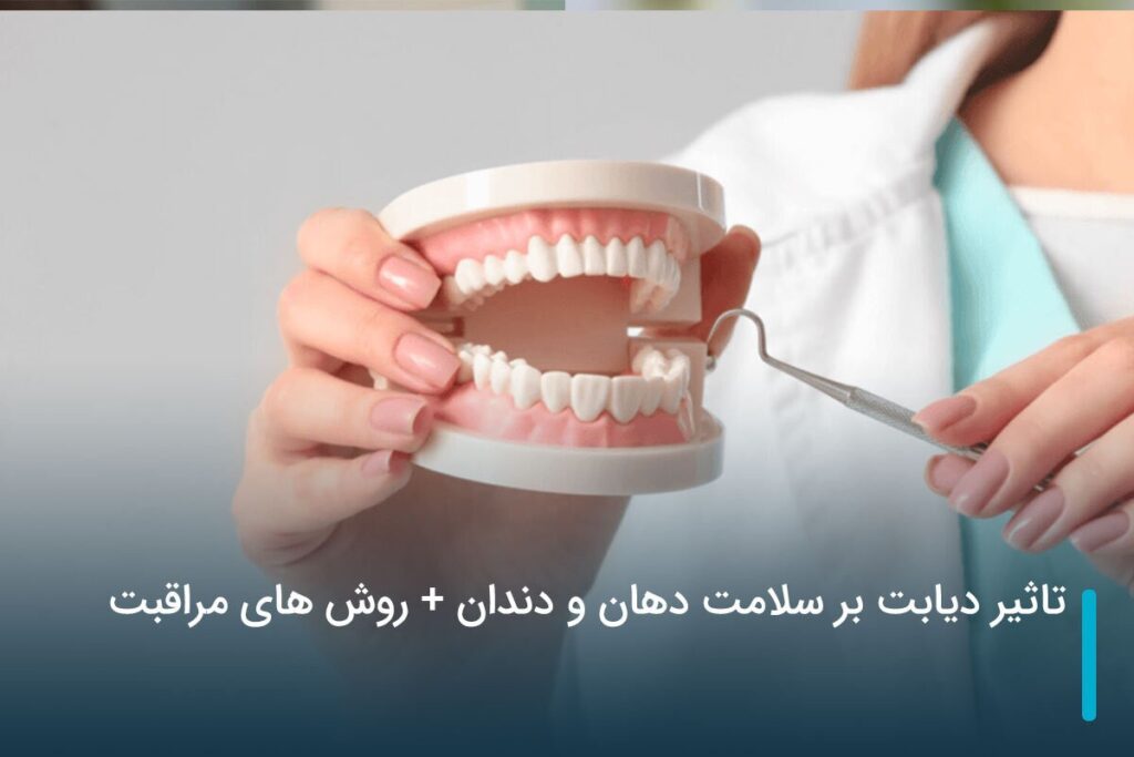 تاثیر دیابت بر سلامت دهان و دندان + روش های مراقبت