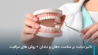 تاثیر دیابت بر سلامت دهان و دندان + روش های مراقبت