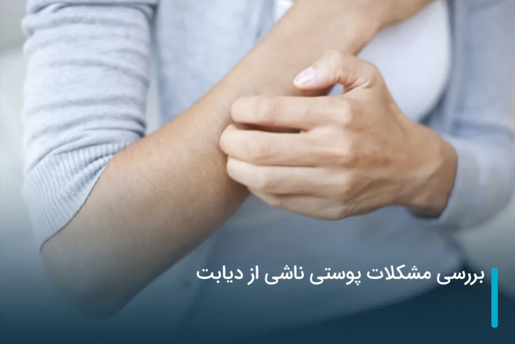 بررسی مشکلات پوستی ناشی از دیابت
