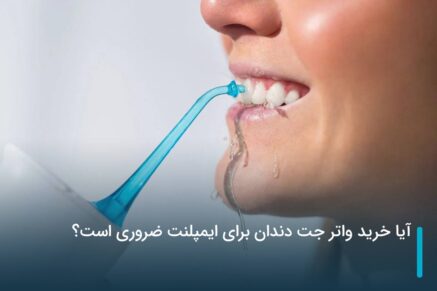آیا خرید واتر جت دندان برای ایمپلنت ضروری است؟