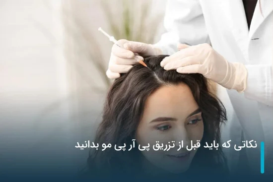 نکاتی که باید قبل از تزریق پی آر پی مو بدانید