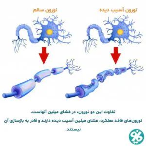 نورون