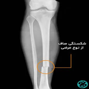 ارتوپدی