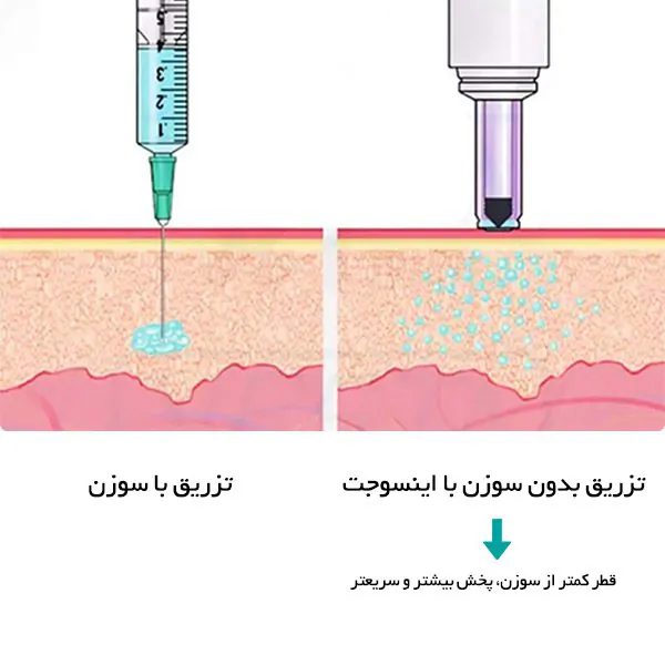 مزایای استفاده از دستگاه تزریق انسولین بدون سوزن اینسوجت