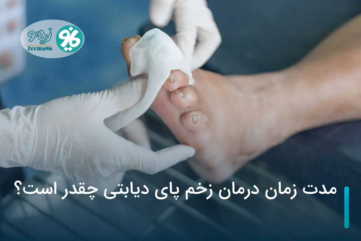 مدت زمان درمان زخم پای دیابتی چقدر است؟